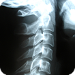 visit_xray